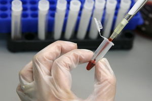 Vakcina usporava HIV