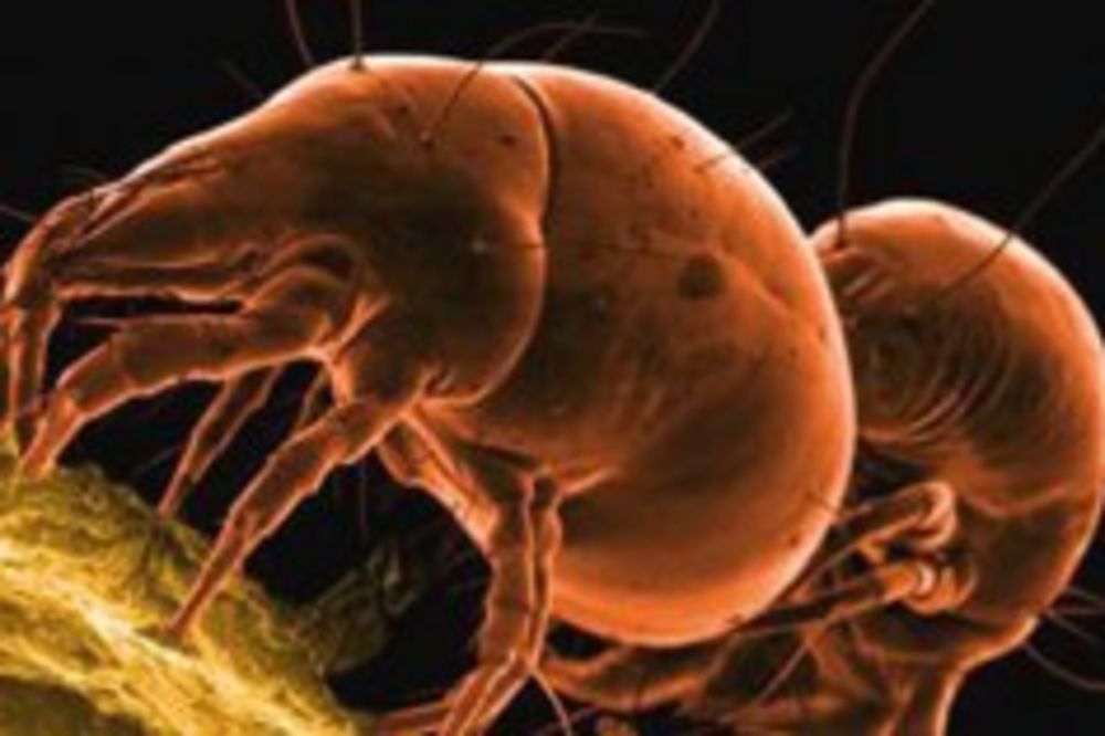 (VIDEO) JEZIVA BIĆA: 10 najodvratnijih parazita koji možda već žive u vama!