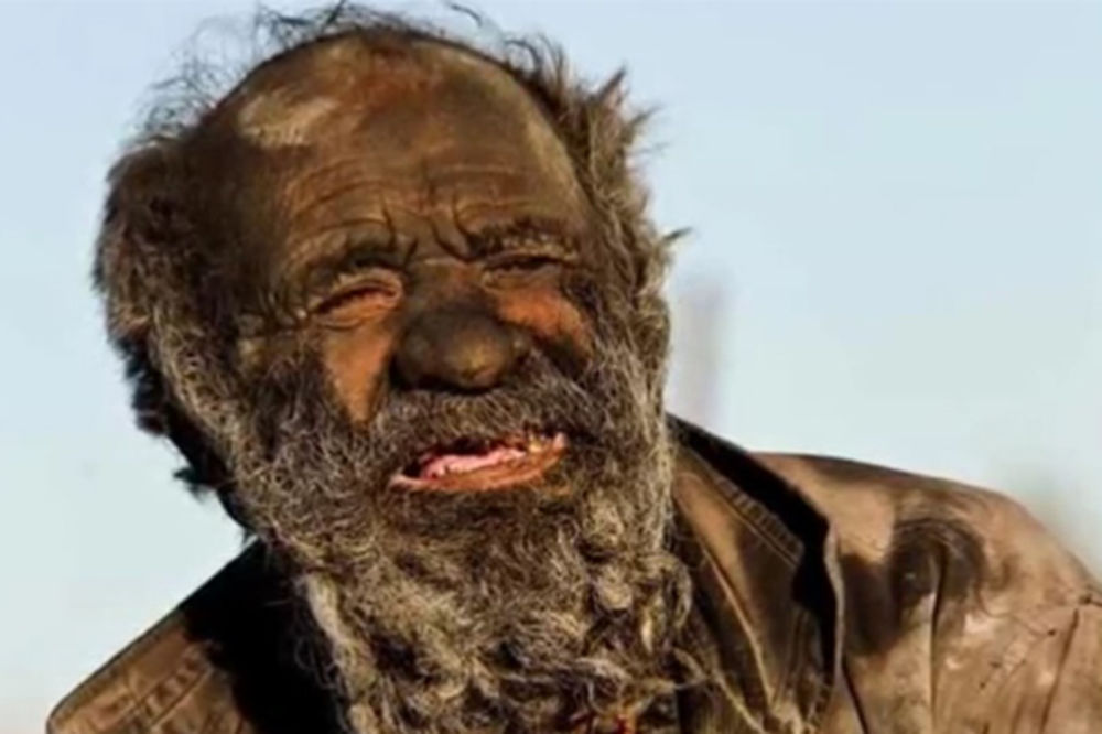 (VIDEO) POTUKAO SVETSKI REKORD: 60 godina nije se okupao i neviđeno smrdi!