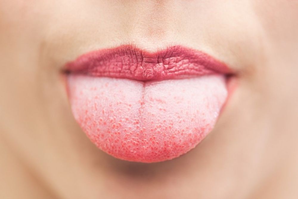 DOBRO POGLEDAJTE U OGLEDALU: 10 promena na jeziku otkriva od čega bolujete