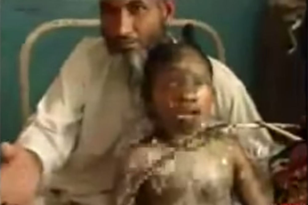(UZNEMIRAVAJUĆI VIDEO) DA SE ČOVEK SLEDI: Ovu devojčicu su živu zapalili jer je stavila karmin