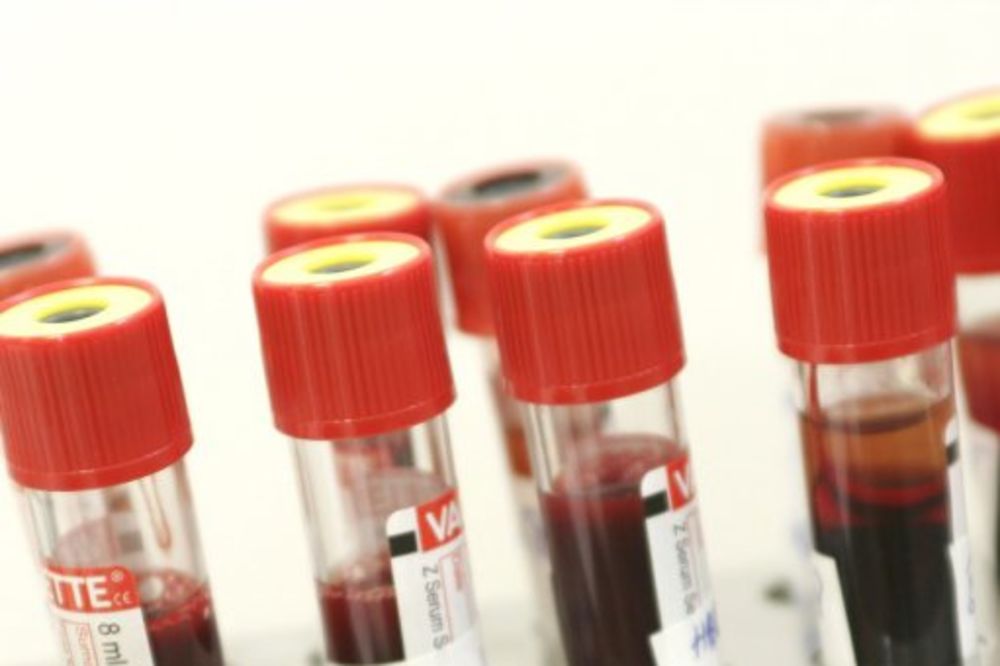 ALARMANTNA SITUACIJA: Nedostaju sve krvne grupe u bolnici u Vršcu
