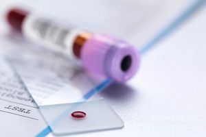 ŠOKANTNO: Austrijske novine štampane krvlju osoba zaraženih HIV-om!