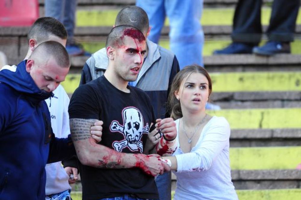 CRNA SLIKA DERBIJA: Britanski mediji uz slike krvavih navijača, podsećaju da je ranije bilo i mrtvih