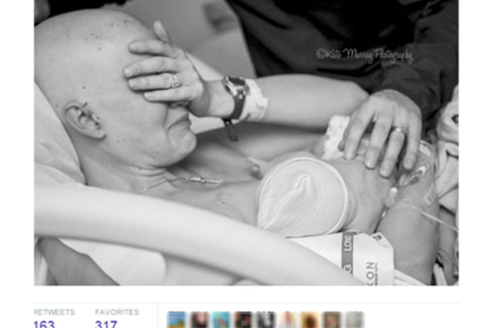 Fotografije koje su ganule svet: Majka obolela od karcinoma prvi put doji svog sina (FOTO)