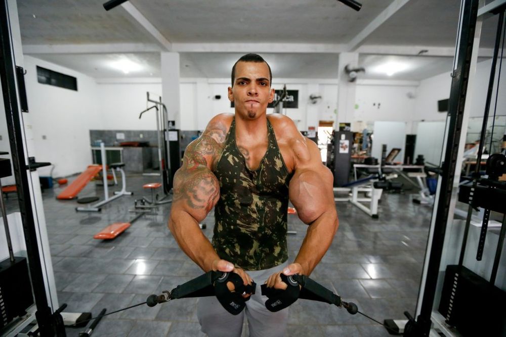 (FOTO) Hteo je da ima najveće bicepse na svetu, ali umalo je ostao bez obe ruke!