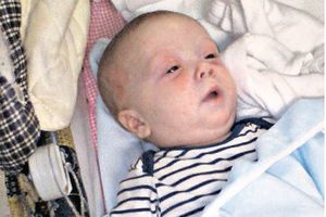 DETE U MODRICAMA: Majka osumnjičena za zlostavljanje bebe tvrdi da joj je sina povredio doktor!