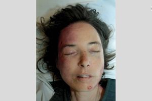 ŽRTVA POMAHNITLOG BOSANCA: Žena koju je Rizvanović pregazio u Gracu još nije identifikovana!