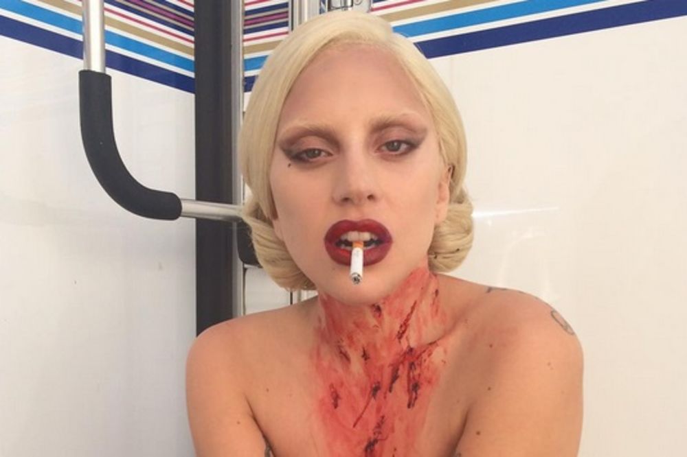 (FOTO) OVOME SE NIKO NIJE NADAO: Lejdi Gaga gola i krvava!
