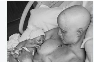 (FOTO) FOTKA KOJA JE RASPLAKALA SVET: Jedna dojka joj odstranjena, a drugom doji bebu!