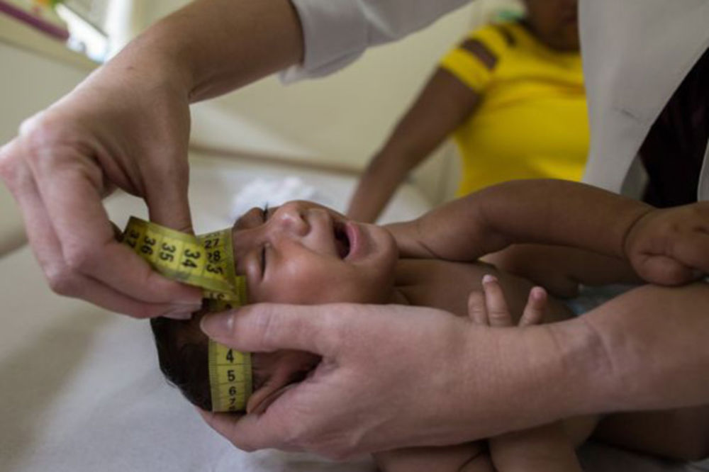 KOLUMBIJA: Više od 2.000 trudnica zaraženo virusom zika