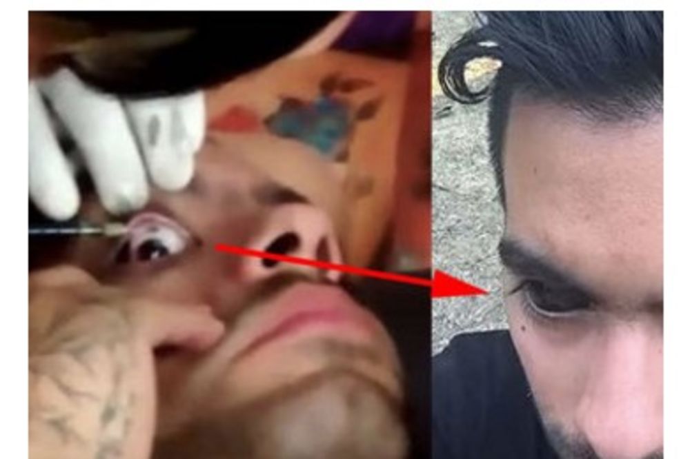 SADA SMO SVE VIDELI: Momak je snimio video kako tetovira očne jabučice...Ne gledajte dok jedete!