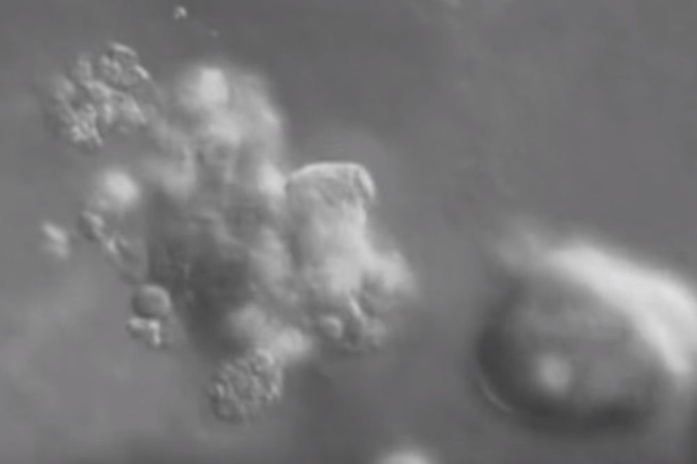 (VIDEO) OVAKO NASTAJE TUMOR: Pogledajte 3D snimak malignih ćelija koje vrbuju zdrave