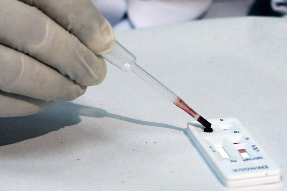 BOLEST NAPREDUJE: Aktivan virus zika otkriven po prvi put u pljuvačci i urinu