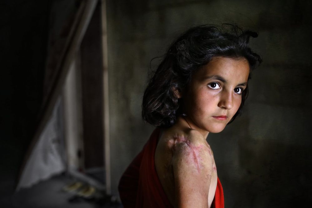 (VIDEO) UPROPAŠĆENE GENERACIJE: Svako treće dete u Siriji ne zna šta je mir