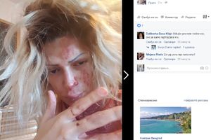 (UZNEMIRUJUĆE FOTOGRAFIJE) KRV NA SVE STRANE: Srpska pevačica brutalno pretučena?