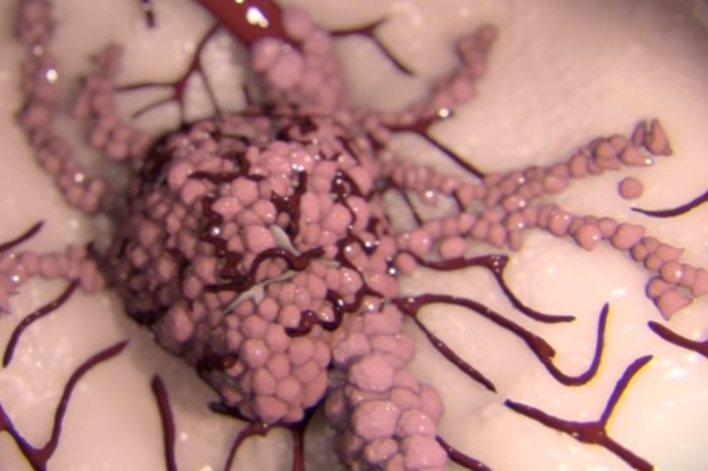 (VIDEO) VIDEO KOJI ŠOKIRA: Evo kako se rak širi kroz telo