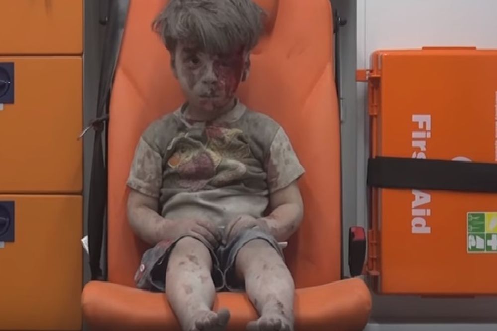 SAM U SUROVOM SVETU: Slika dečaka (5) iz Sirije umazanog krvlju i prašinom rasplakala je svet