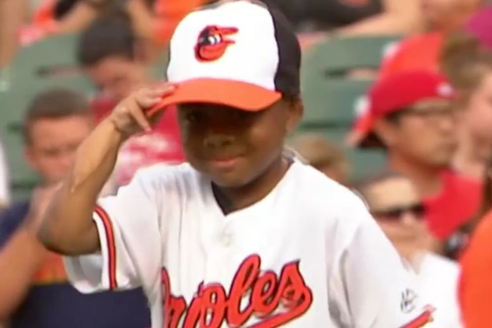 (VIDEO) MALI HEROJ: Posle uspešne transplatacije šaka ovaj mališan želi da se bavi sportom