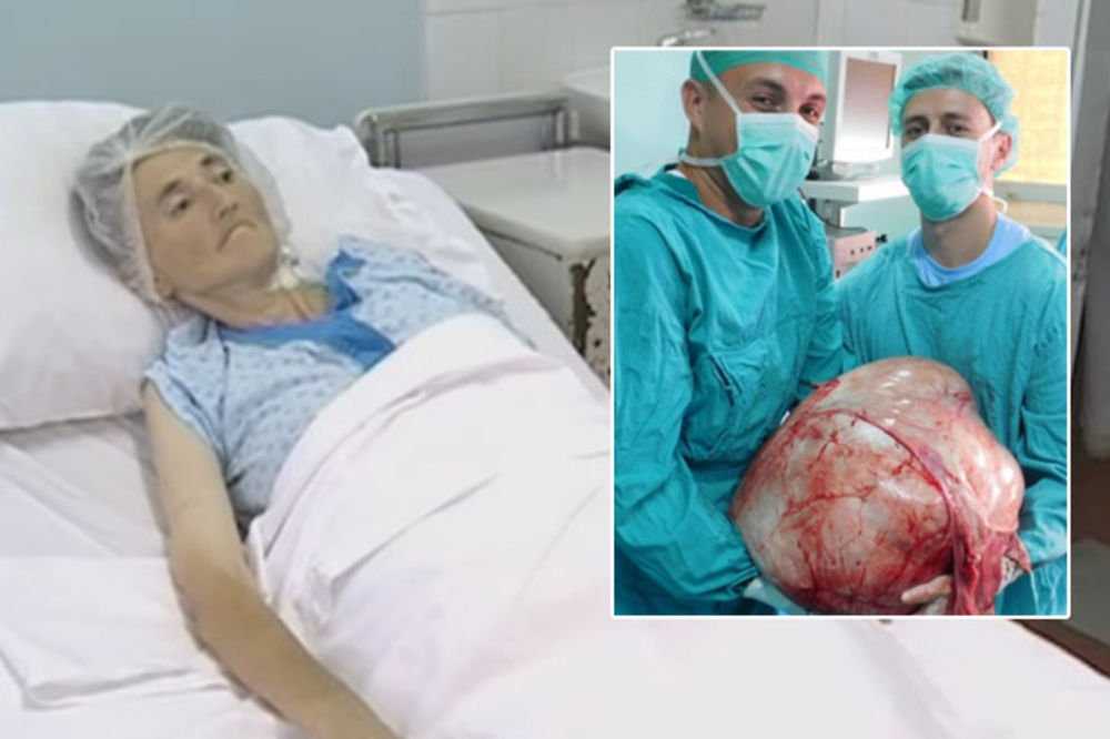 (VIDEO) TUMOR TEŽAK 31 KILOGRAM NOSILA U STOMAKU GODINAMA: Stoja je kod lekara otišla zbog noge!