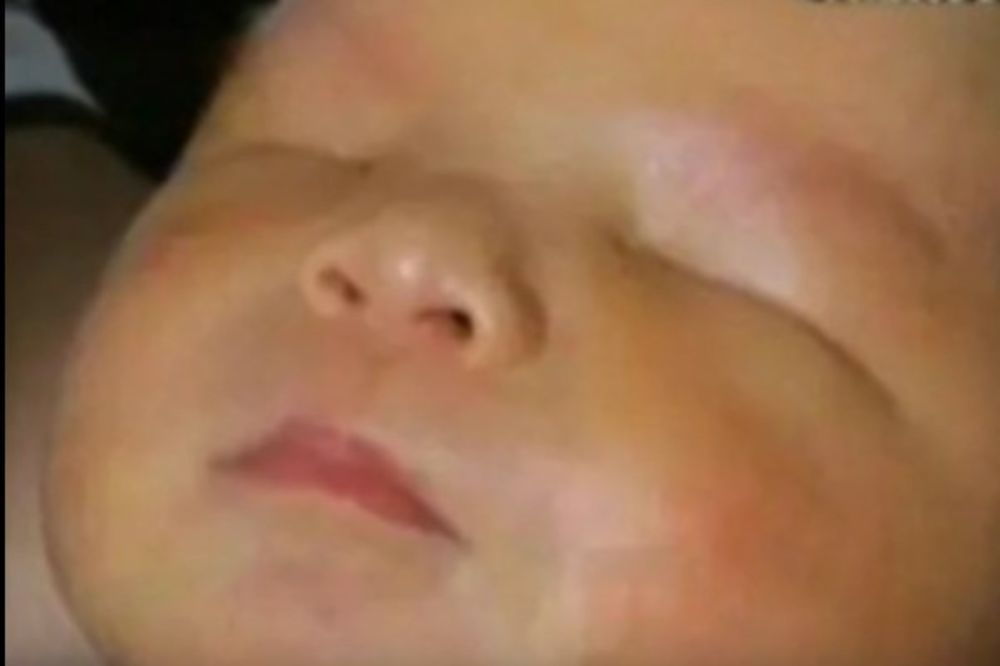 (VIDEO) PORODICA NEUTEŠNA: U Kini se rodio dečak bez oba oka, lekari tvrde da su nemoćni
