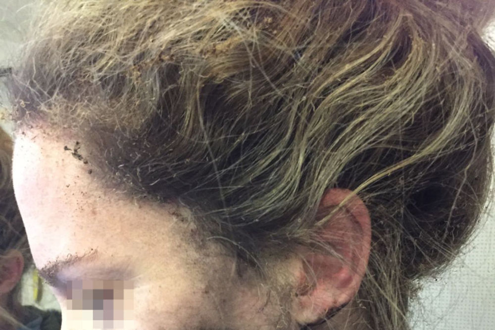 DRAMA U AVIONU: Putnici eksplodirale slušalice u ušima i zapalile lice