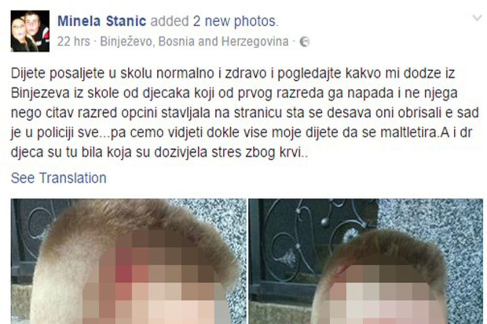 (FOTO) MAJKA OBJAVILA STRAVIČNE SLIKE SINA: Dete joj godinama trpi vršnjačko nasilje, škola ćuti!