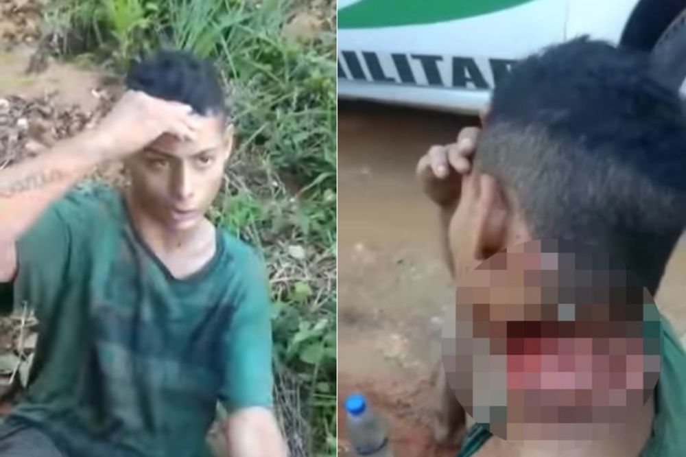 (UZNEMIRUJUĆI VIDEO) JEDVA IZVUKAO ŽIVU GLAVU! Lopovi napali mladića i brutalno ga isekli po vratu