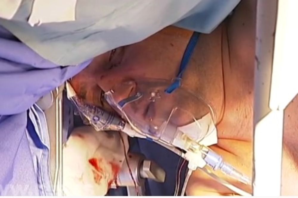 VELIKI USPEH SRPSKIH LEKARA: Hirurzi Beograđaninu izvadili tumor iz mozga dok je bio budan!