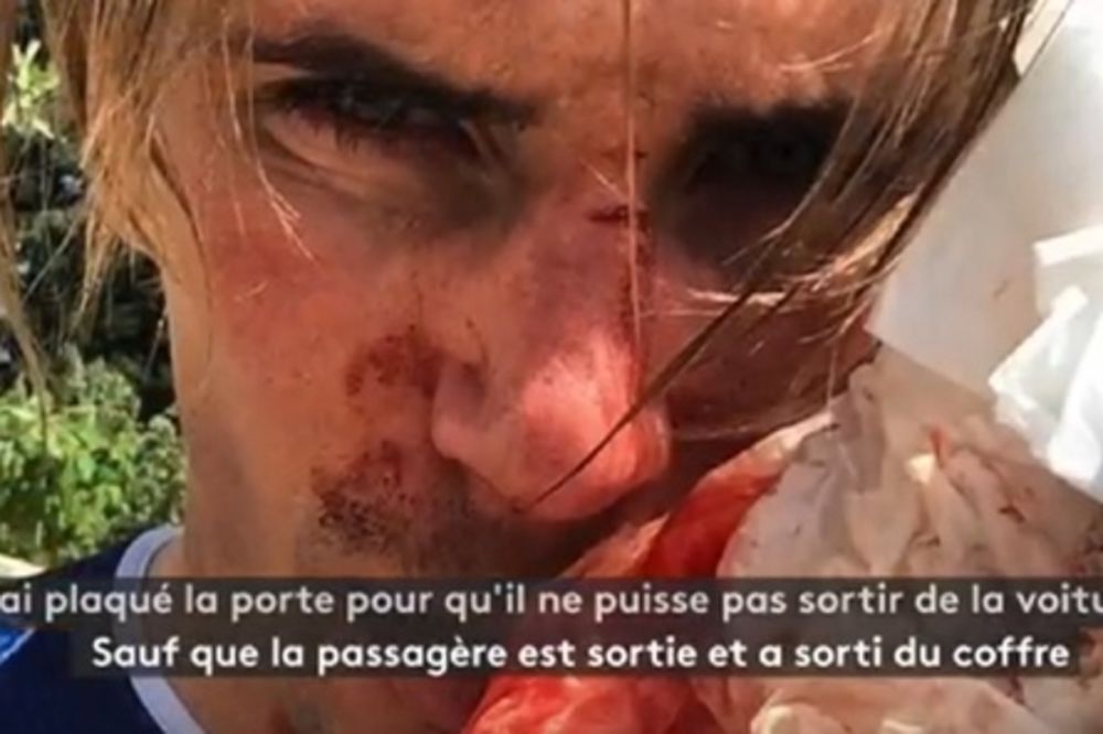 JEZIVE SCENE U PARIZU: Umalo zgazio biciklistu na treningu, a onda ga pretukao bejzbol palicom VIDEO