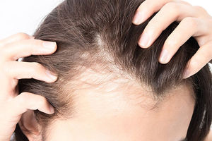 BRZO DO ZDRAVE KOSE: 5 tipova ulja koja će ti ojačati dlaku i sprečiti opadanje!