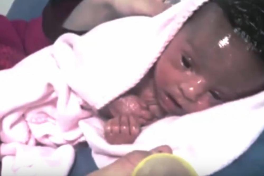 (VIDEO) ZBOG NJENE KOŽE, MAMA JE ZOVE SIRENA: Ovoj bebi je dijagnostikovana bolest, ali postoji razlog zbog kog je posebna
