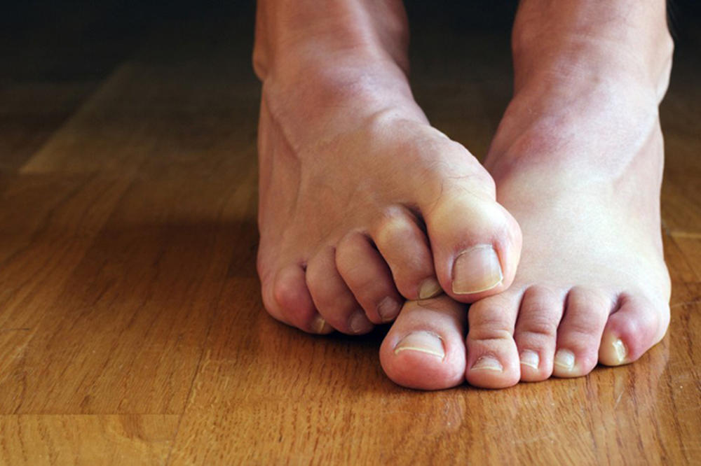 LEDENA STOPALA? Evo kako aluminijumska vlakna mogu da pomognu kod dijabetičkog stopala?!