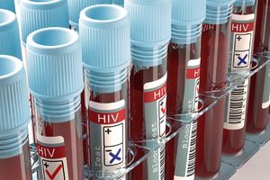 BESPLATNO TESTIRANJE NA HIV: Najbitnije da se infekcija otkrije na vreme i da se započne lečenje