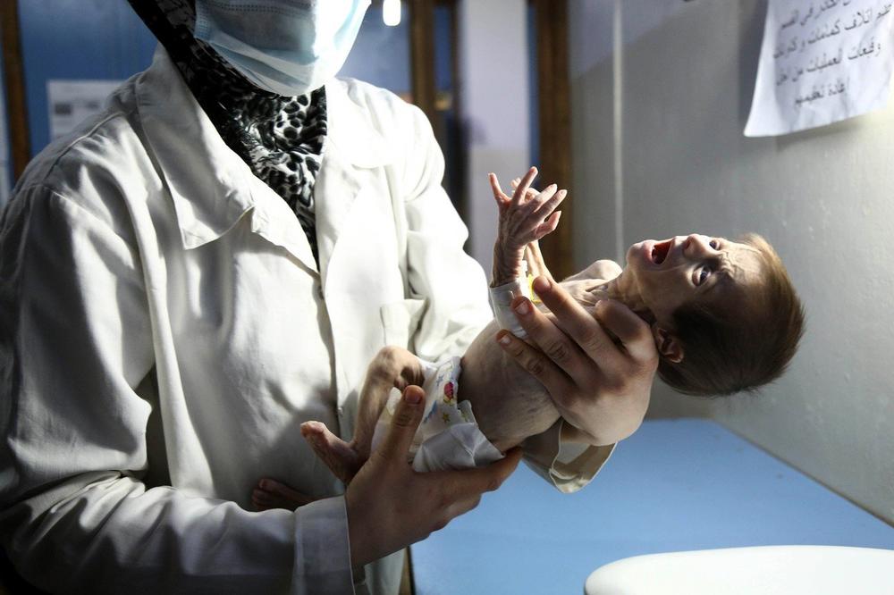(UZNEMIRUJUĆE) OVE SLIKE POKAZUJU SAV UŽAS RATA U SIRIJI: Beba stara svega 35 dana umrla od gladi