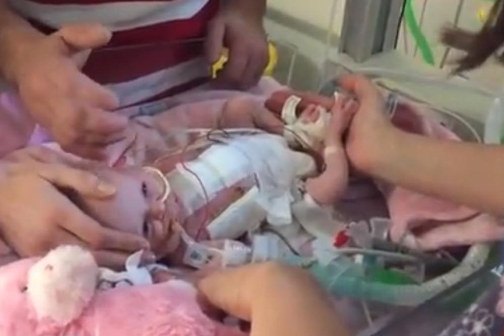 (UZNEMIRUJUĆI VIDEO): Beba rođena sa srcem van tela! Sa prve 3 sedmice preživela 3  OPERACIJE!