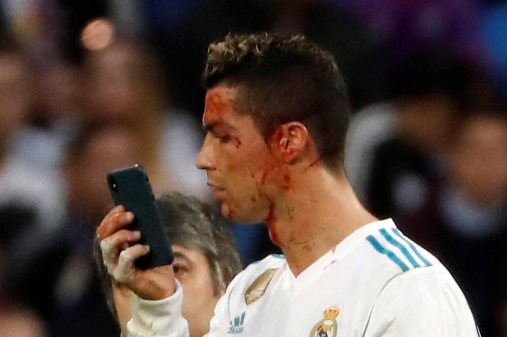 (UZNEMIRUJUĆI VIDEO) KRV LILA SA KRISTIJANOVE GLAVE: Pogledajte Ronaldovo unakaženo lice posle meča sa Deportivom