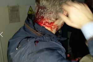 NAPADNUT BORKO STEFANOVIĆ U KRUŠEVCU: Predsednik Levice Srbije krvave glave završio u bolnici, napadači uhapšeni!