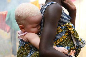 BLISKI ROĐACI ISKASAPILI DECU DA BI VEŠTIČARILI: Tela 10 otetih albino mališana nađena masakrirana i bez organa