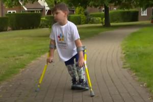 DEČAK SAKUPIO VIŠE OD MILION FUNTI ZA BOLNICU: Ostao bez nogu kao beba, a sada je pravi heroj! (VIDEO)