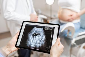 LEPA VEST IZ GAK "NARODNI FRONT" Prva trudnoća u Srbiji putem doniranih spermatozoida