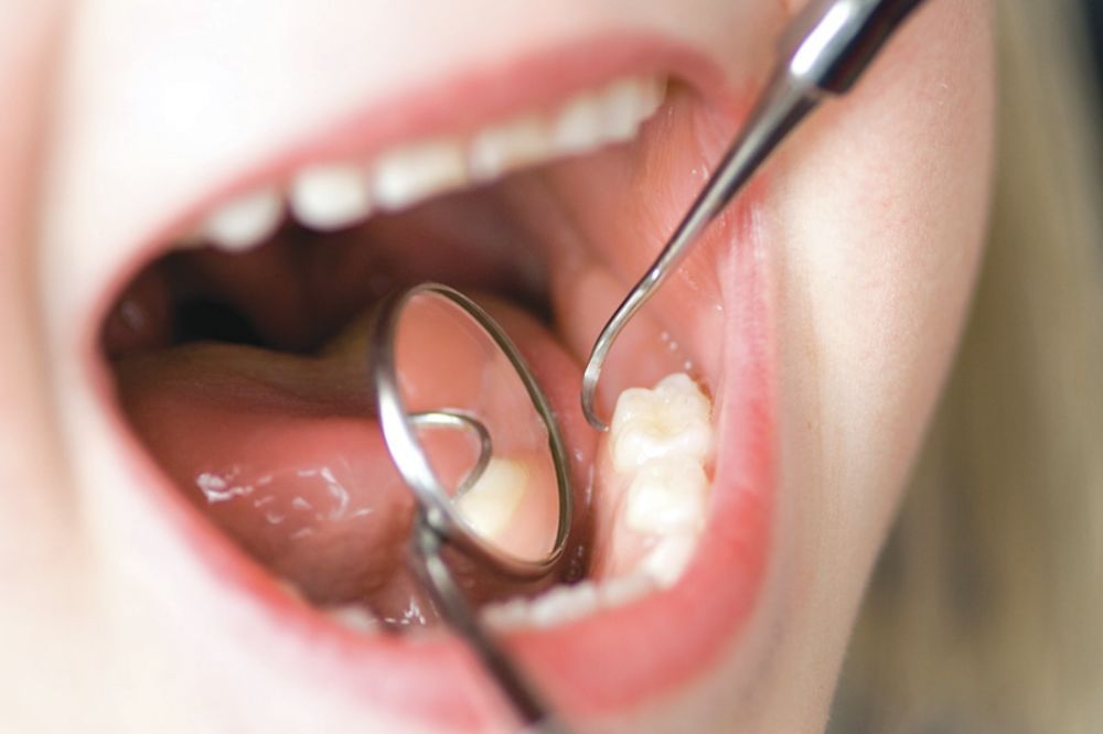IMAJU LOŠIJE ZUBE: Sportisti bi češće morali kod stomatologa