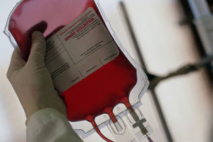 APEL BEOGRAĐANIMA: Duplo smanjene rezerve krvi!