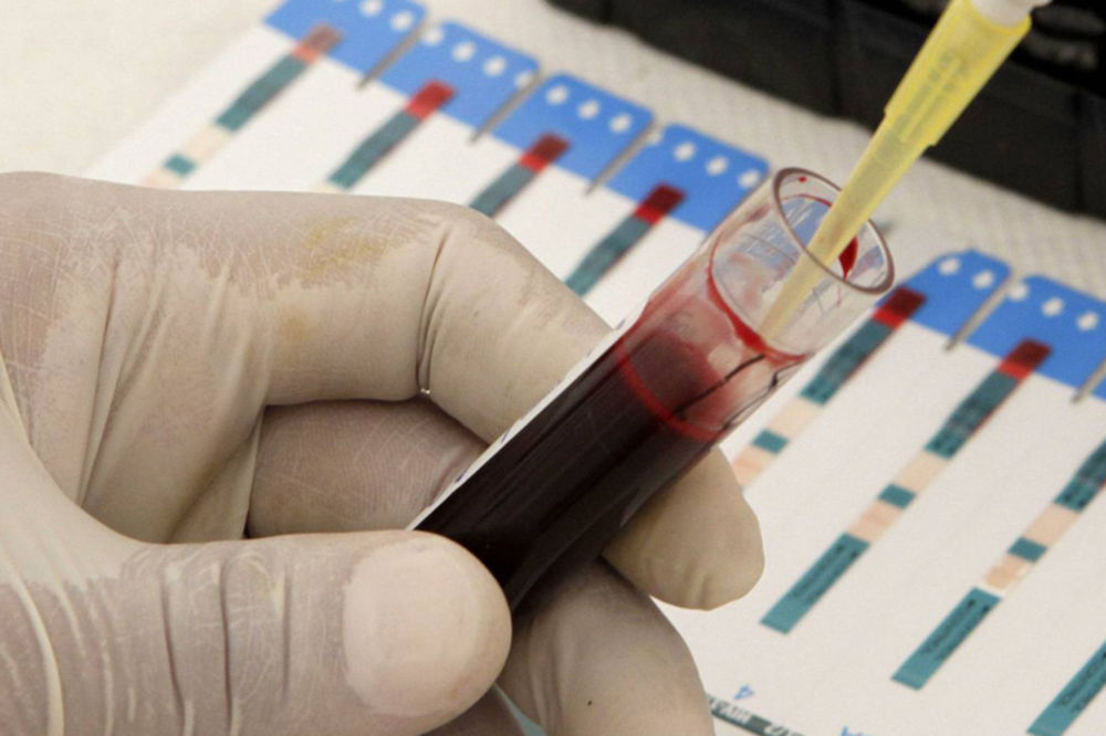 EUREKA: Rumunski naučnici napravili veštačku krv