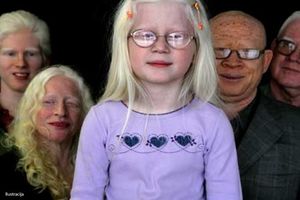 Najveća albino porodica na svetu