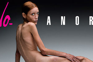 Proterane anoreksične manekenke