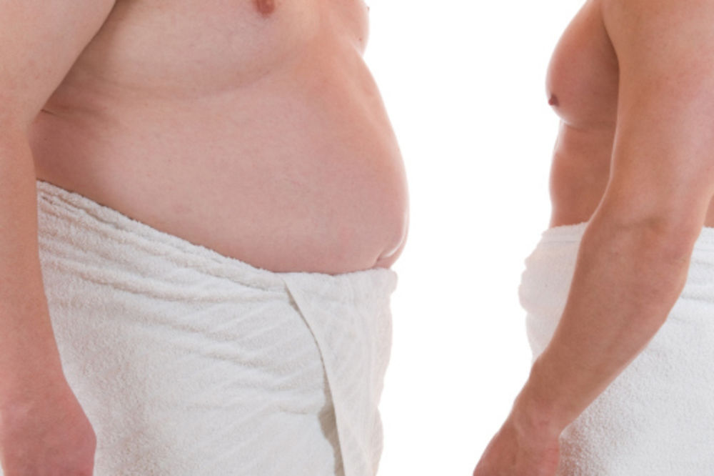 Gojaznost neuporedivo zdravija od mršavosti