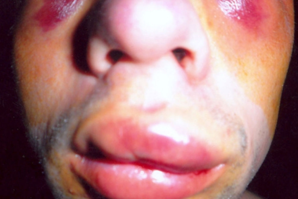 Trojica boksera brutalno pretukli studenta