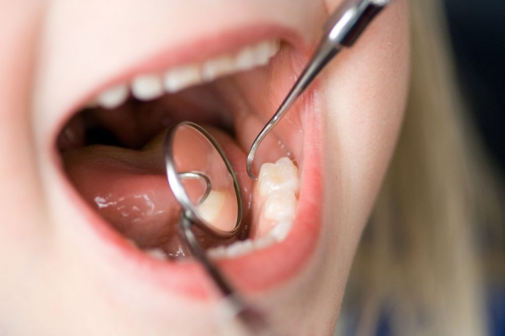 Nedelja zdravlja usta i zuba od 21. do 27. maja