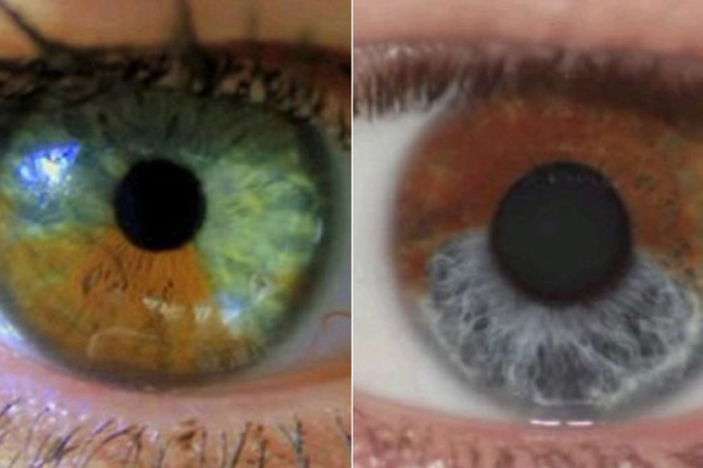 До скольки меняются глаза. Цвет глаз. Цвета глаз у человека. Коричневая радужка глаза. Голубо карие глаза.